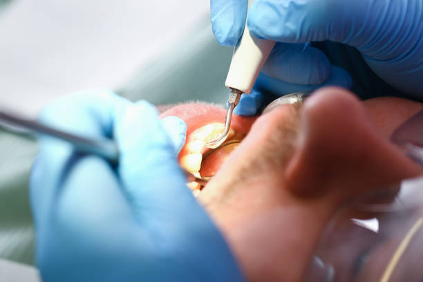 Best Emergency Root Canal Treatment in Vandenberg Af, CA