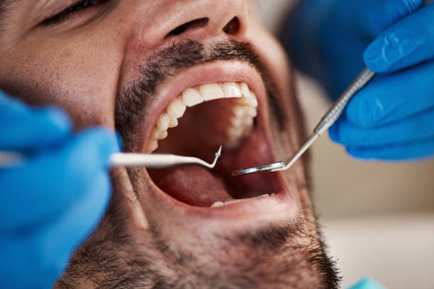 Best After-Hours Dental Trauma Care in Vandenberg Af, CA